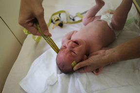 Dr. Vanessa Van Der Linden, the neuro-pediatrician who first recognized and alerted authorities over the microcephaly crisis in Brazil, measures the head of a 2-month-old baby with microcephaly in Recife, Brazil.