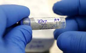 Development of Zika virus vaccine underway in India WHO