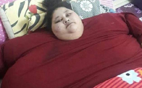 World's heaviest woman undergoes surgery for obesity in Mumbai
