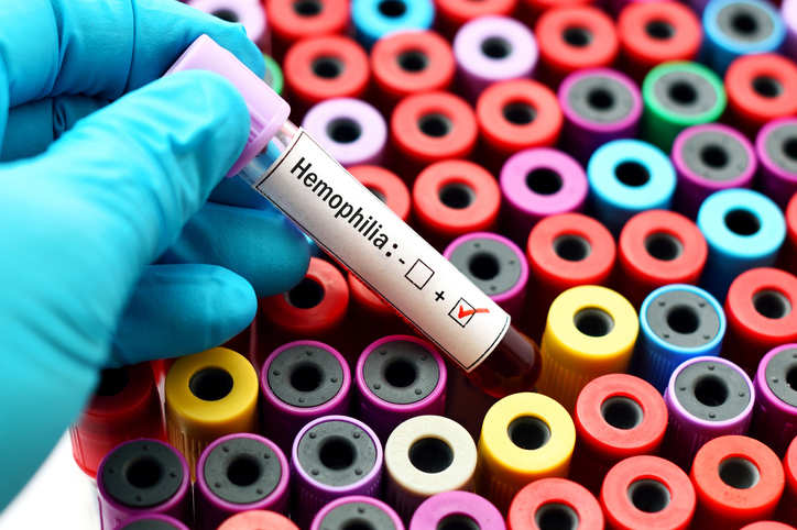 80% hemophilia cases undiagnosed in India