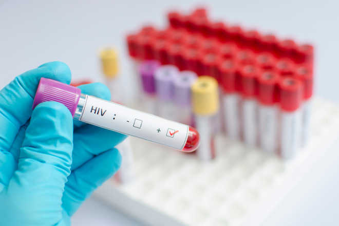 HIV infection ups risk of heart failure, stroke