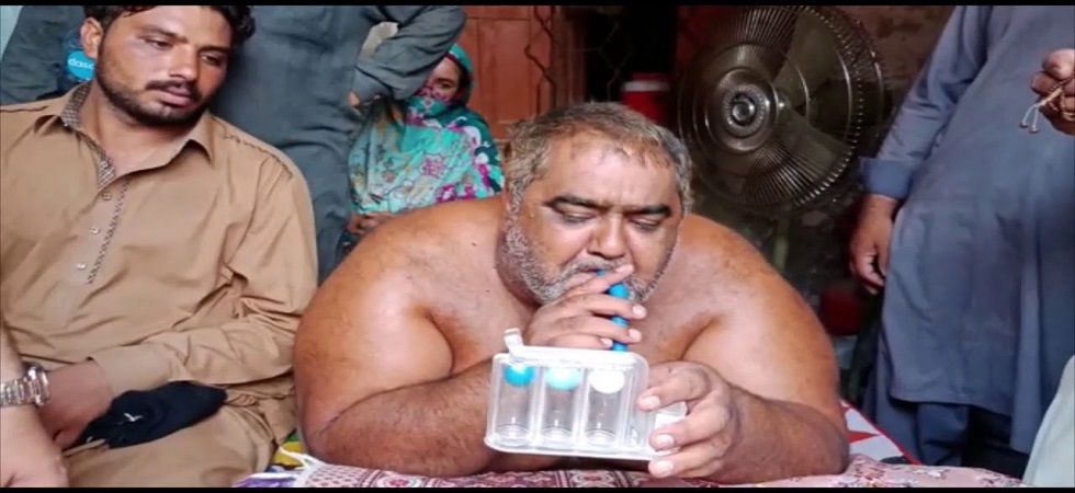 Pakistan's heaviest man undergoes successful liposuction surgery