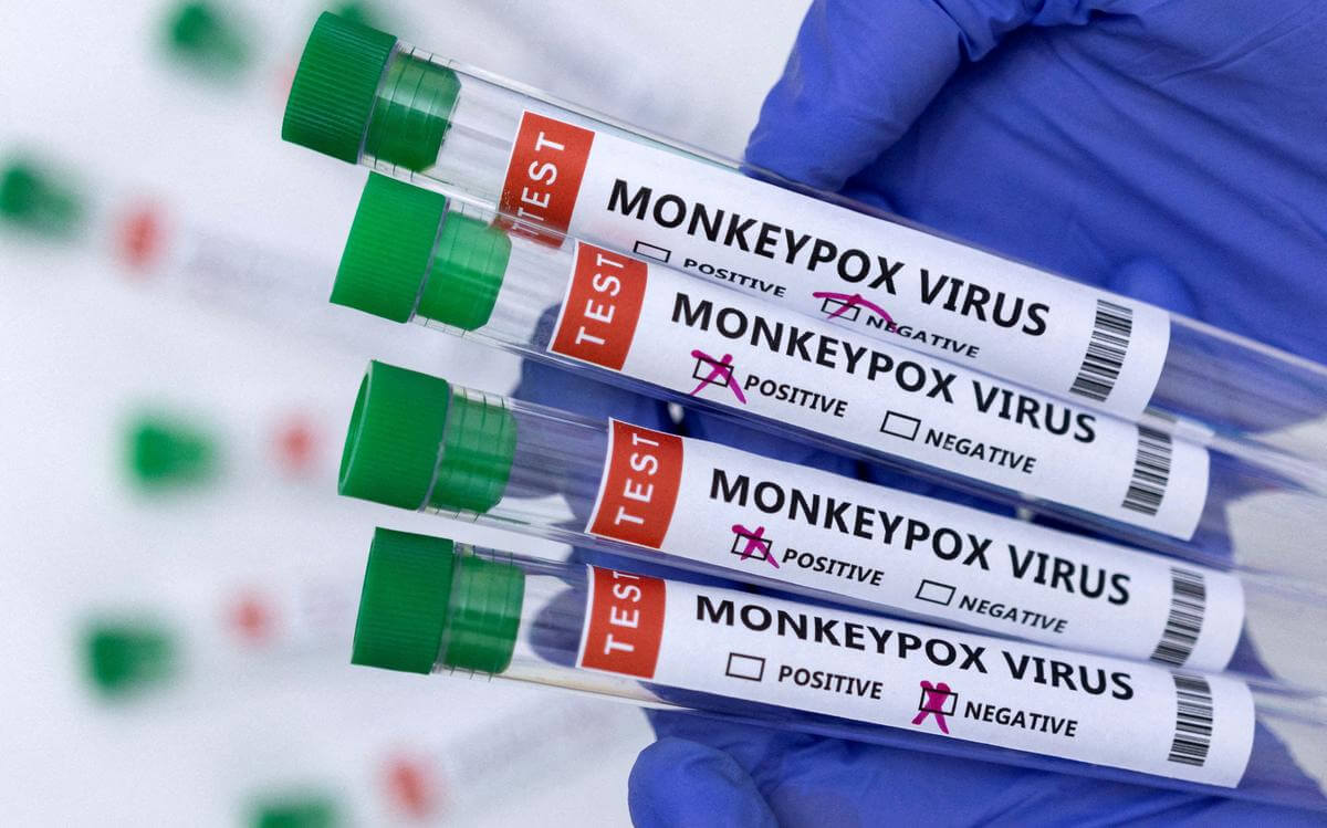Union Govt's guidelines for battling Monkeypox outbreak