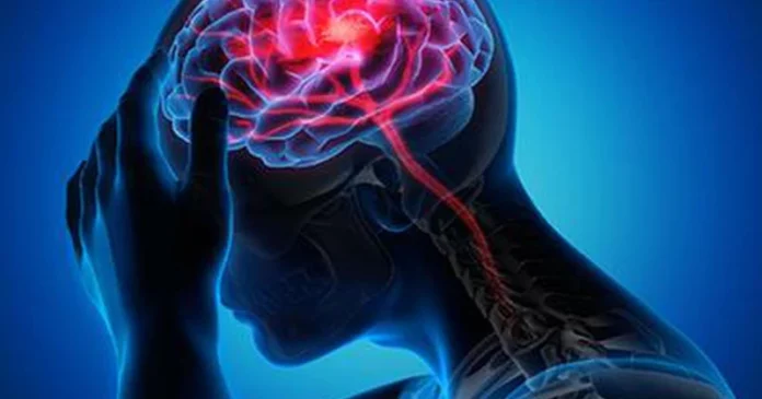 Stroke could cause about 10 million deaths annually by 2050