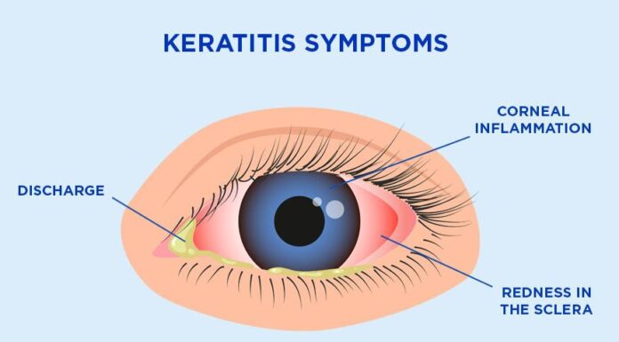 Best Eye Hospital in Pune