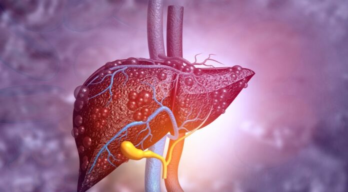 Why excess sugar, oil are as dangerous for liver as alcohol Liver