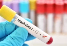 Nipah Virus