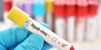 Nipah Virus