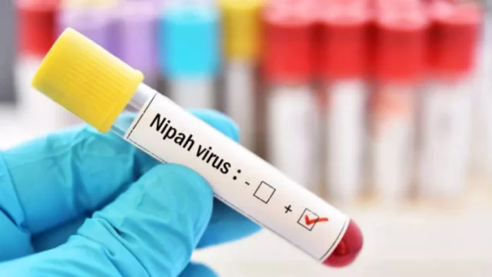 Nipah Virus