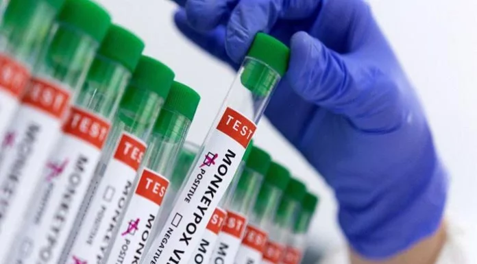 Pakistan: Peshawar emerges as ‘epicentre’ of mpox as tally reaches five Mpox