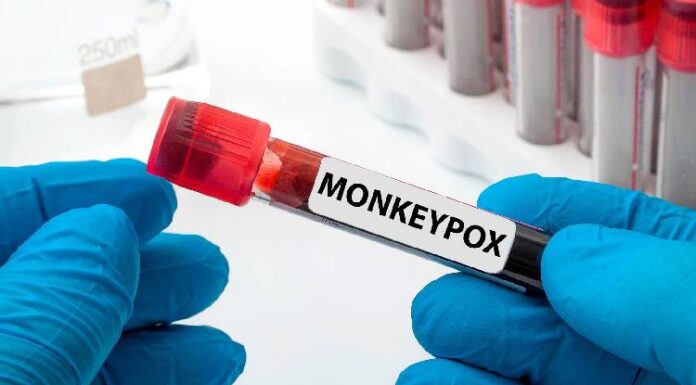 mpox