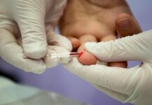 HIV