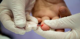 HIV