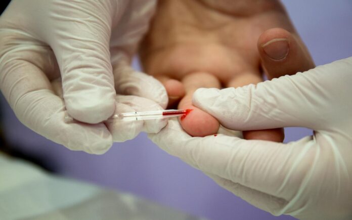HIV