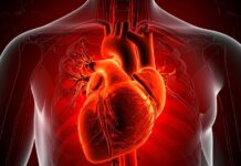 heart disease