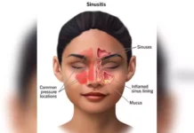 sinus