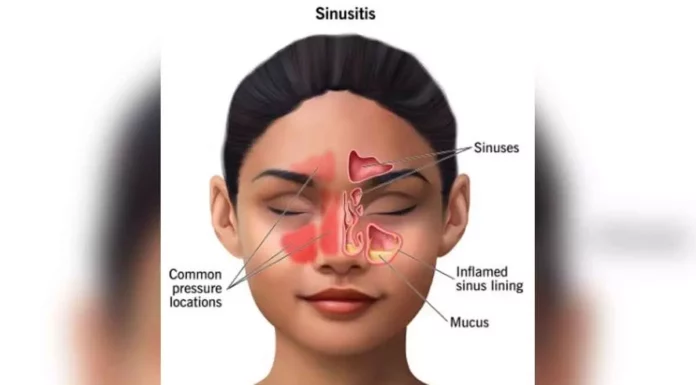 sinus