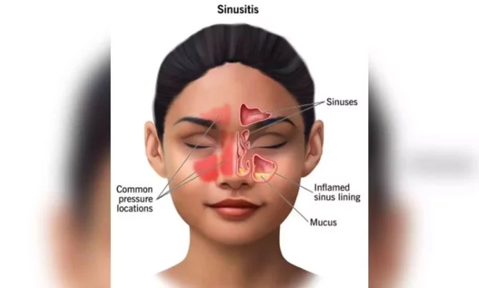 sinus