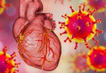 unusual heart rhythm disorder