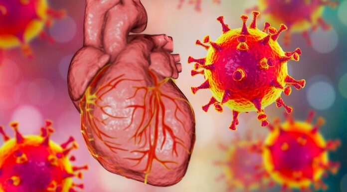 unusual heart rhythm disorder