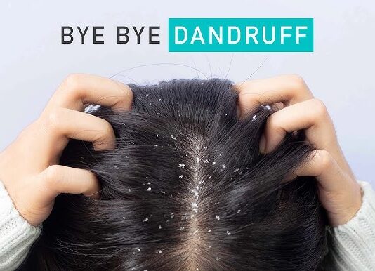 Natural Dandruff Remedies and How Ketoconazole 2% Shampoo Boosts Scalp Health Dandruff Remedies