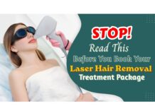 Laser Hair Removal