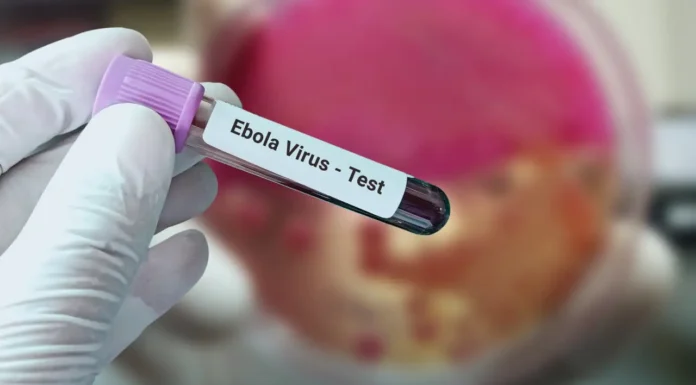 Rajasthan: Suspected Ebola case reported in Jaipur, woman from Uganda isolated Ebola